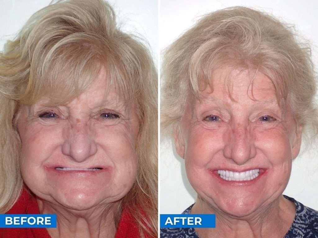 Before After Tammy