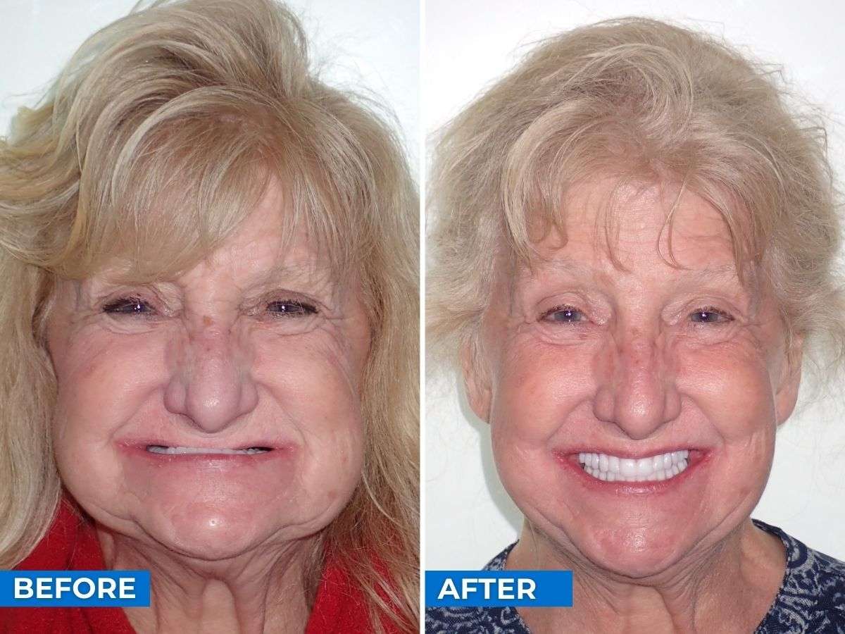 Before After Tammy
