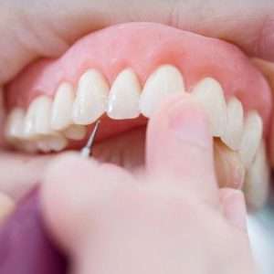 Final Touch Denture