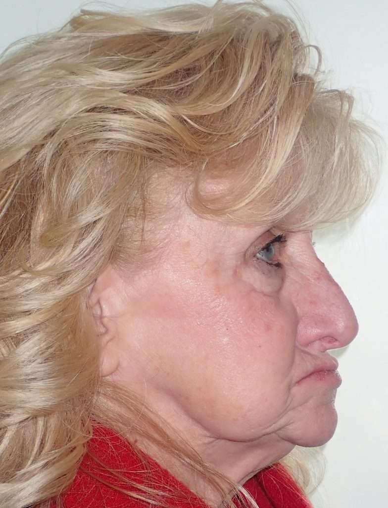 Patient Testimonial Tammy