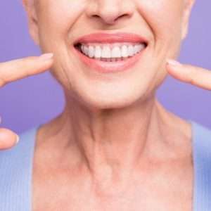after dental implants